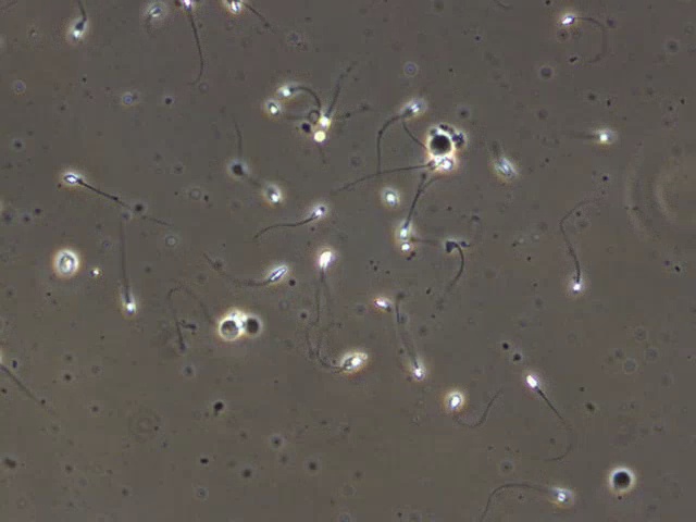 Sperm Detection sperm Object Detection Model by sperm