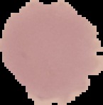 extended_malaria project thumbnail