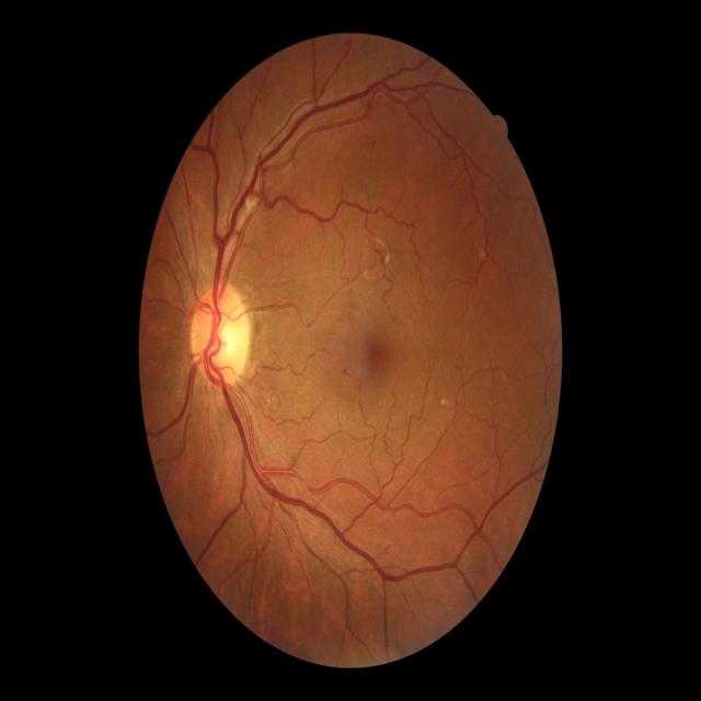 DR_combined_dataset 2 with tess Object Detection Dataset by DR