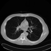 image dicom project thumbnail