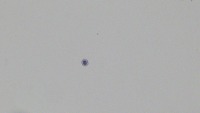 normal cell detection project thumbnail