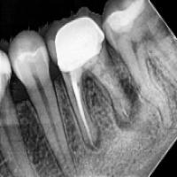 Dental project thumbnail