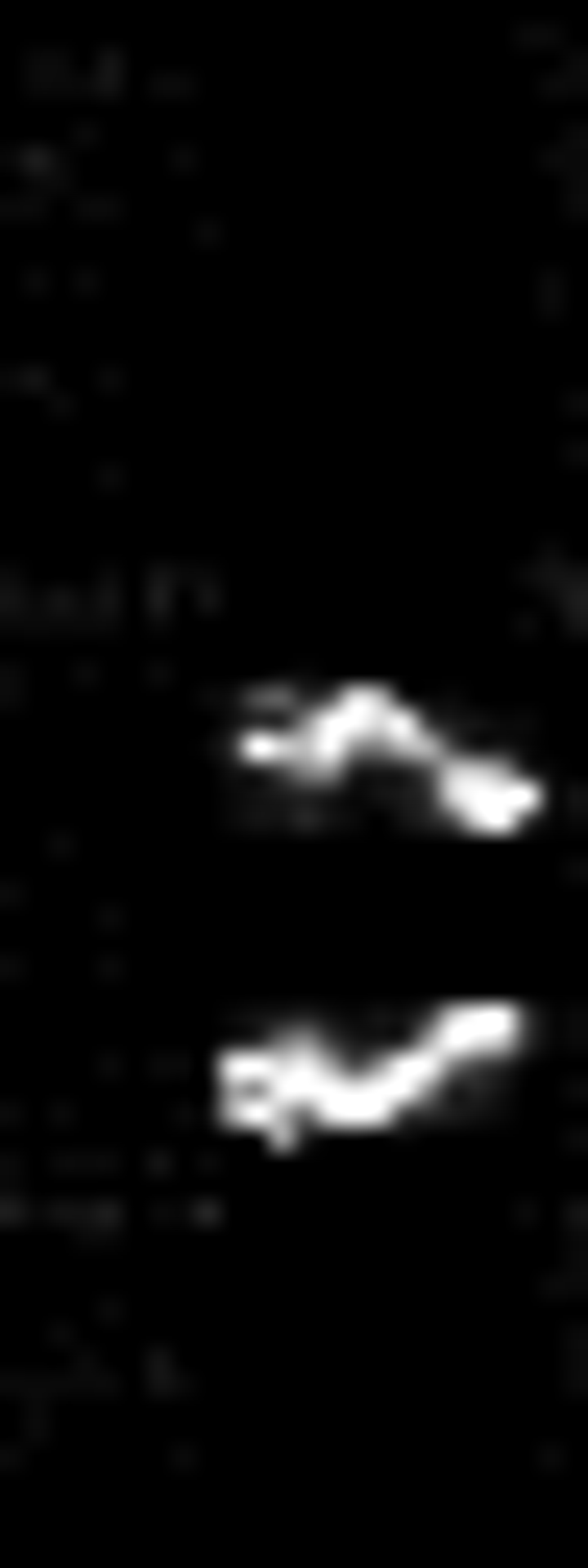 xxnn - Roboflow Universe