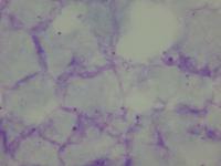 P. Falciparum project thumbnail