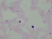P. Vivax project thumbnail