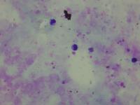 P. Malariae project thumbnail