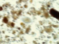 deteksi telur cacing tes 2 project thumbnail