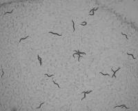 nematode-detection-v2 project thumbnail