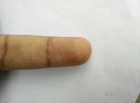 finger_segmentation project thumbnail