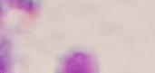 Non-Sperm project thumbnail