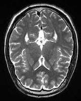 new tumor Instance Segmentation Model by ThiTran