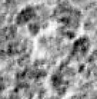 Lobe Segmentation project thumbnail