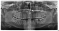 Imported_FigshareDataset project thumbnail