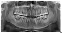 DentSeg3_4Class_RCT_Val_Extract project thumbnail