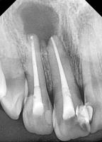 new dental dataset project thumbnail