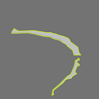 Rust Detection Instance Segmentation Dataset by Rust detection
