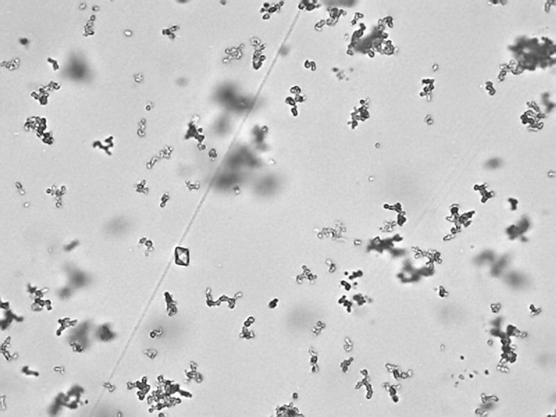 Calcium Oxalate Crystals Object Detection Model by Robo