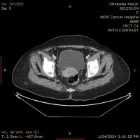 Only Bladder Images project thumbnail