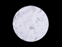 RBC Platelet segmentation project thumbnail