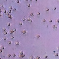 cell counting project thumbnail