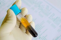 blood plasma project thumbnail