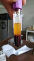 pr bloodserum project thumbnail