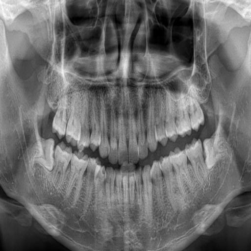 Colloge Project Roboflow Universe colloge-project-roboflow-universe