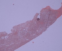 glomerule-2-detection- project thumbnail