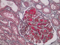 Glomeruli to be verified S/NS project thumbnail