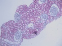 glomerule-detection- project thumbnail