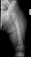 bone project thumbnail