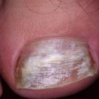 ALL NAILS mel_heal_other project thumbnail