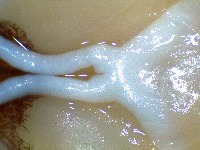 Mouse Optic Nerve project thumbnail