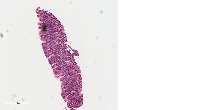 h pylori project thumbnail