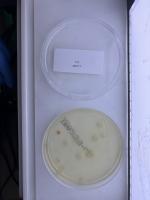 BactIA Colonies project thumbnail