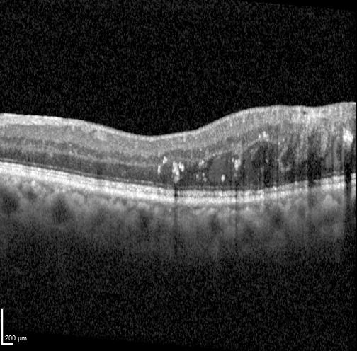 DRIL-Detection Object Detection Dataset by thesis