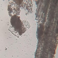 vorticella_tespit project thumbnail