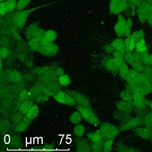 Calcium Cell Data - Roboflow Universe
