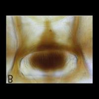 Cibarium project thumbnail
