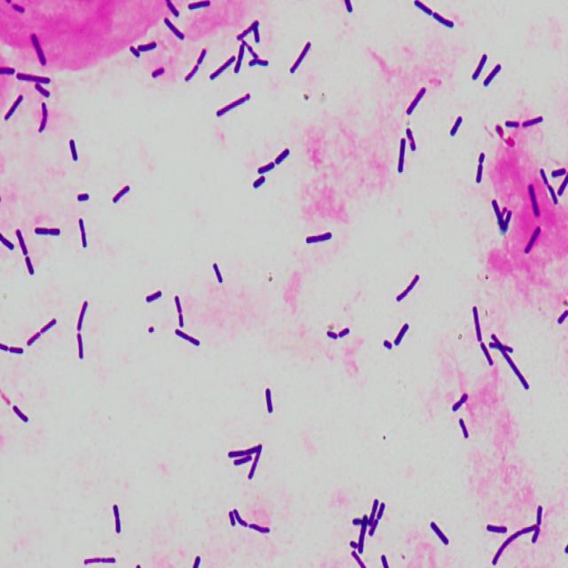 Api Bacilus Bacillus Object Detection Model by Kdicons