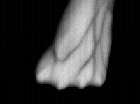Vein project thumbnail