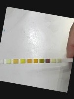 Urine Test Strips Multi Label project thumbnail