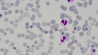 Knowlesi&Falciparum project thumbnail