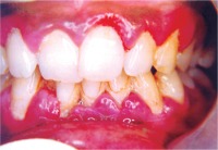 Monitoring Mouth App project thumbnail