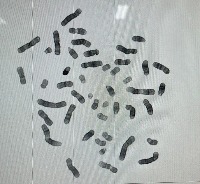 chromosome segmentation 1.2 project thumbnail