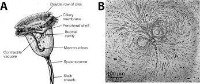vorticella project thumbnail