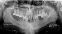 DENTAL AI project thumbnail