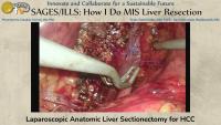 Laparoscopic Anatomic Liver Sect project thumbnail