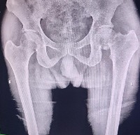 Proximal Femur Fractures project thumbnail