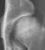 Canine Hip Dataset - FCI Grading project thumbnail